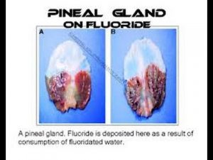 Is the Pineal Gland Being Purposely Suppressed?