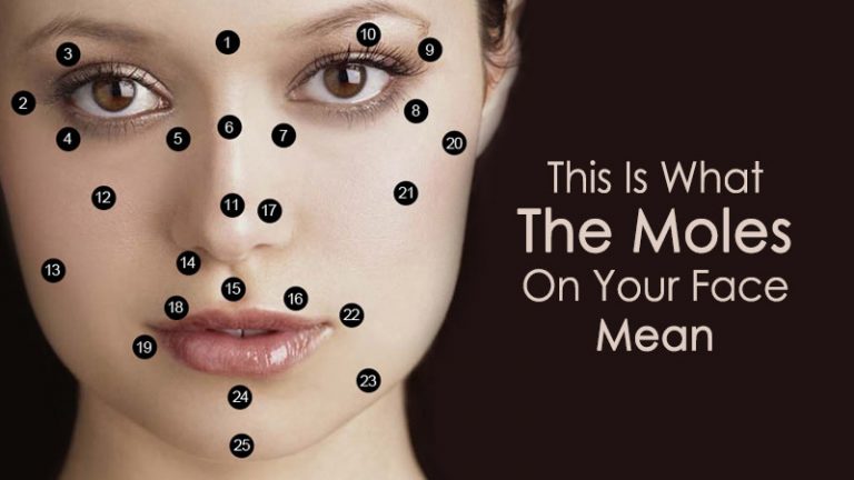 how-to-remove-moles-on-face-permanently-visit-dermatologist